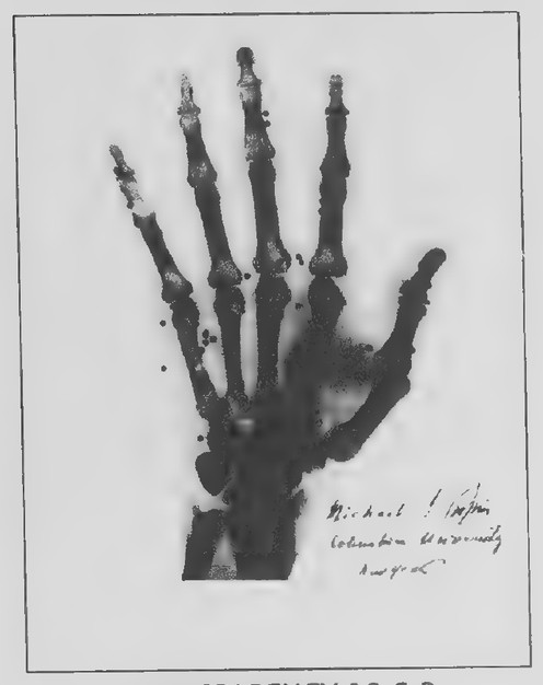Transparency 10-6-2: X-ray of bird shot in hand